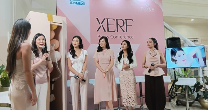 Ingin Tampil Fresh dan Natural di Usia 30 Tahun, Jolene Marie Gencar Lakukan Collagen Banking